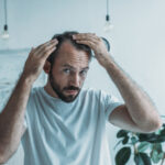 man suffering from hair loss looking in mirror